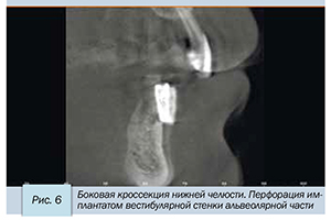 Седов-7.jpg Седов-7.jpg