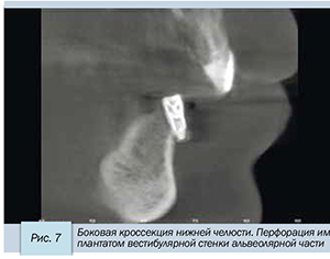 Седов-71.jpg Седов-71.jpg