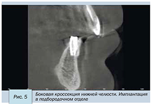 Седов-6.jpg Седов-6.jpg