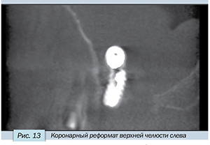 Седов-13.jpg Седов-13.jpg